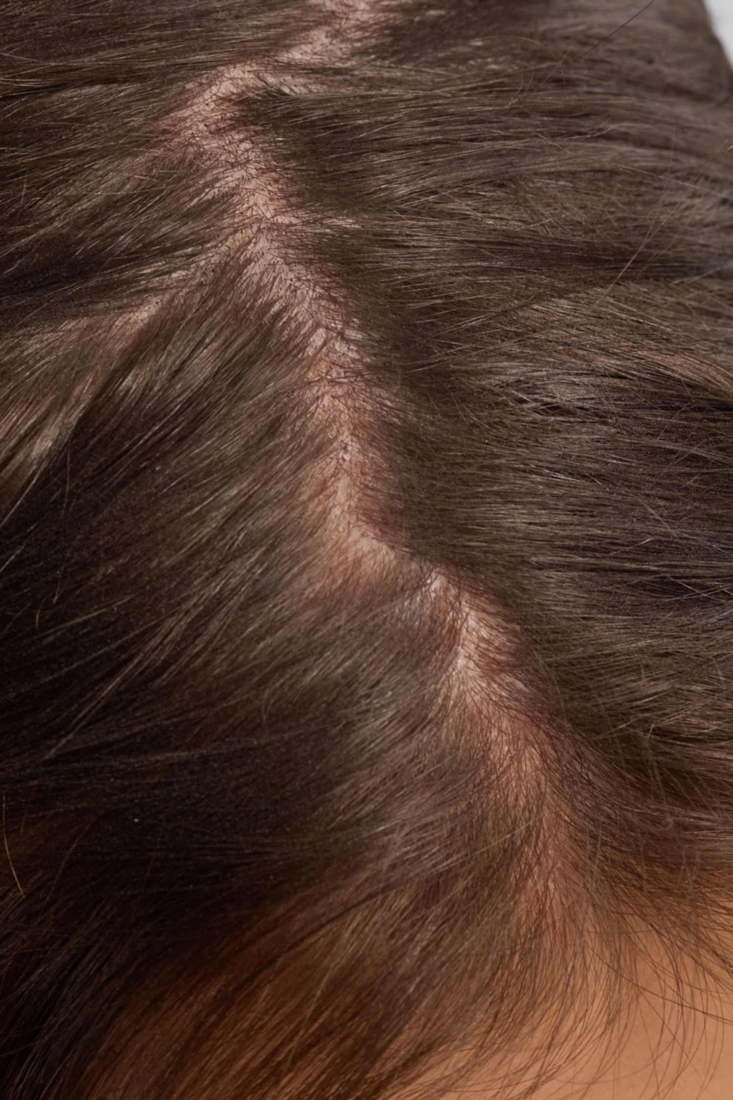 Strengthening Hair & Scalp Oil